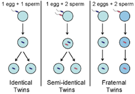 Types of twins.