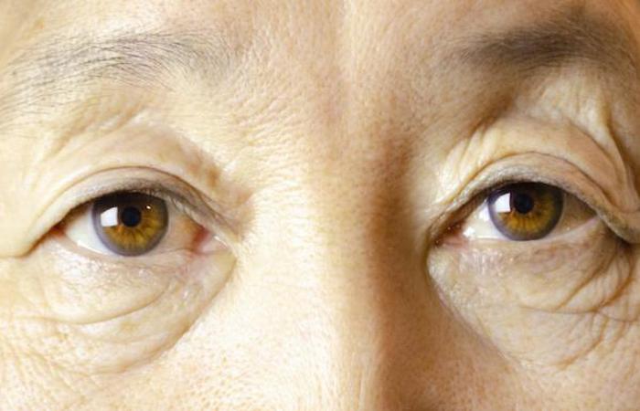 Hazel eyes.