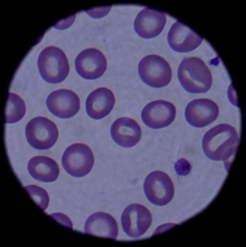 Red blood cells.