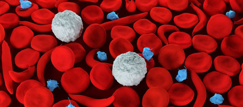 Sickle cells.