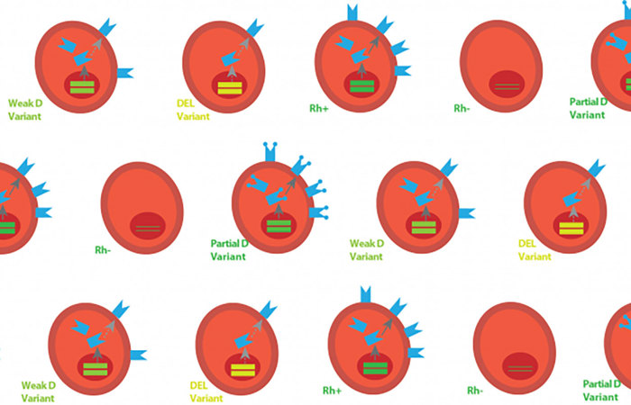 Rhd gene variants.