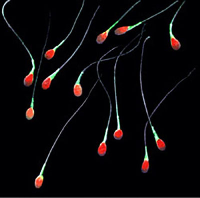 Sperm cells.