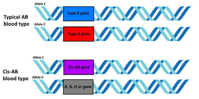 Cis-AB allele.