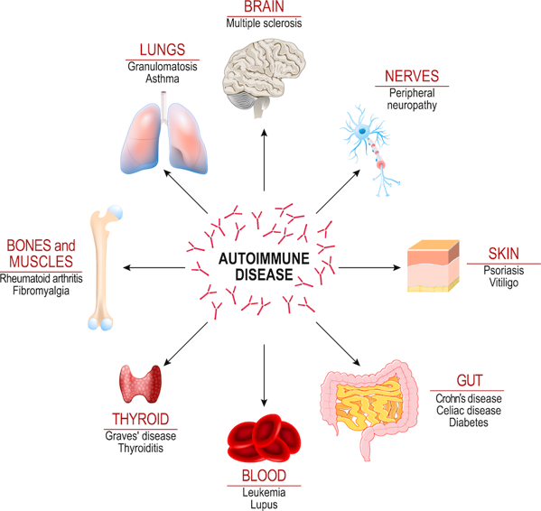 Autoimmune disorders