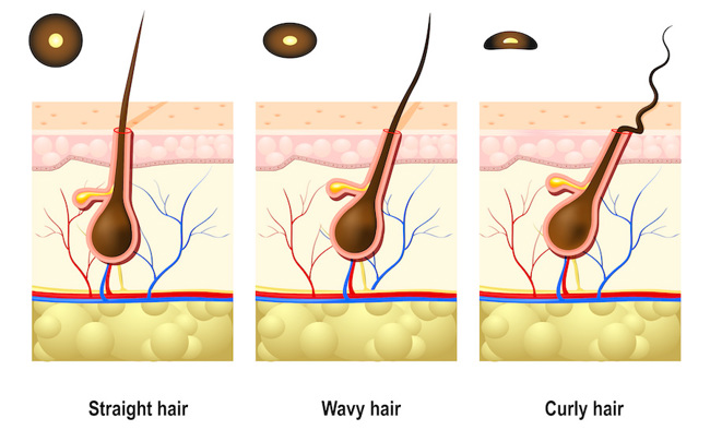 Hair follicle shapes.